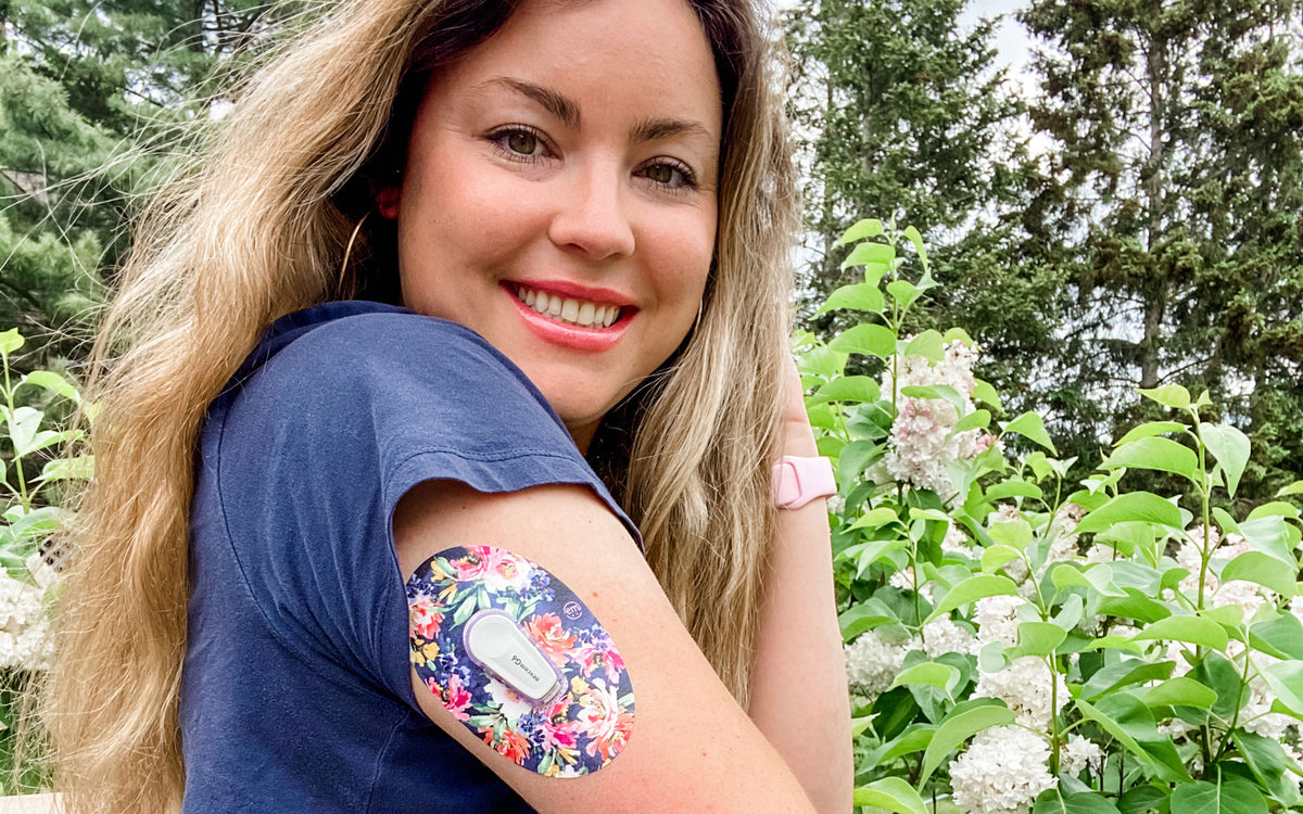 How to make your Dexcom Stay Longer - ExpressionMed