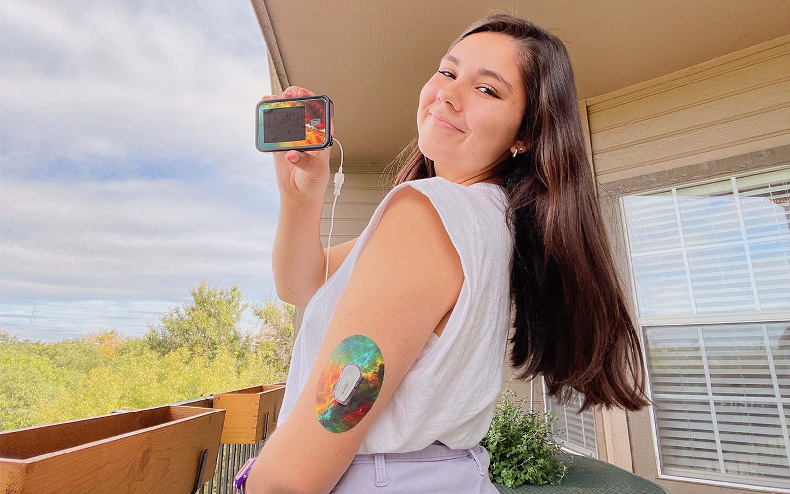 Dexcom and tandem pump