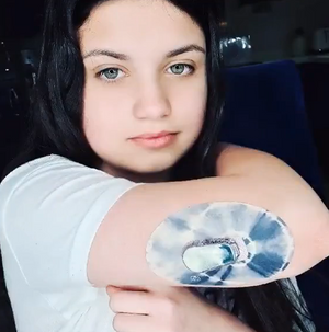Girl with Overcast Tie Dye Dexcom G6 Tape and Transmitter Sticker on arm