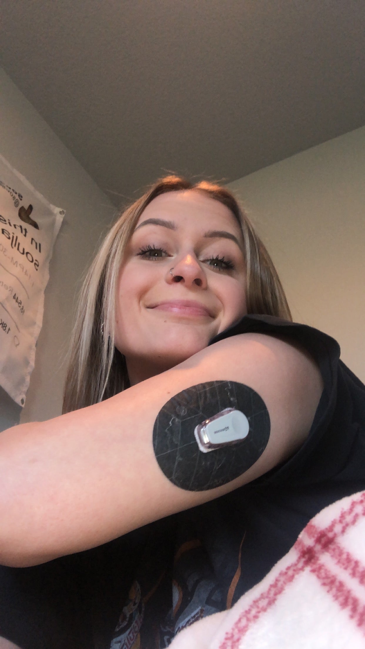 Girl with Black Marble Dexcom G6 Tape on arm