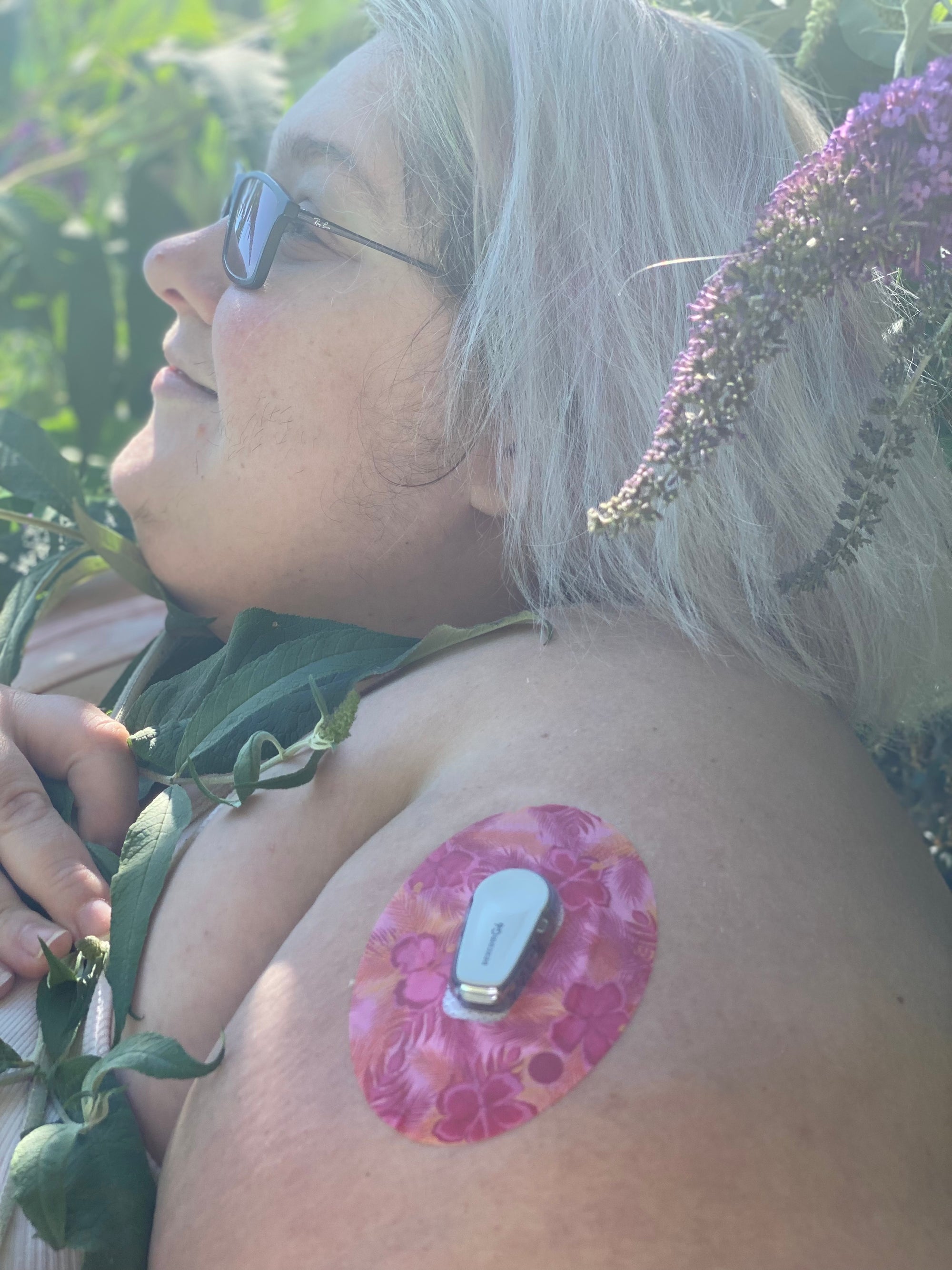 ExpressionMed Pink Hibiscus Dexcom G6 Tape