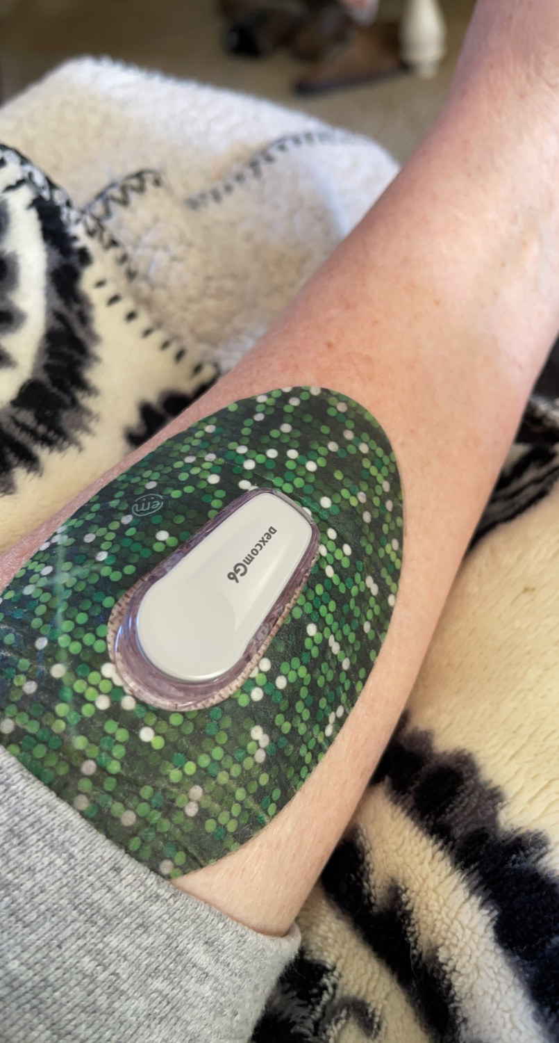 ExpressionMed Green Glam Dexcom G6 Tape