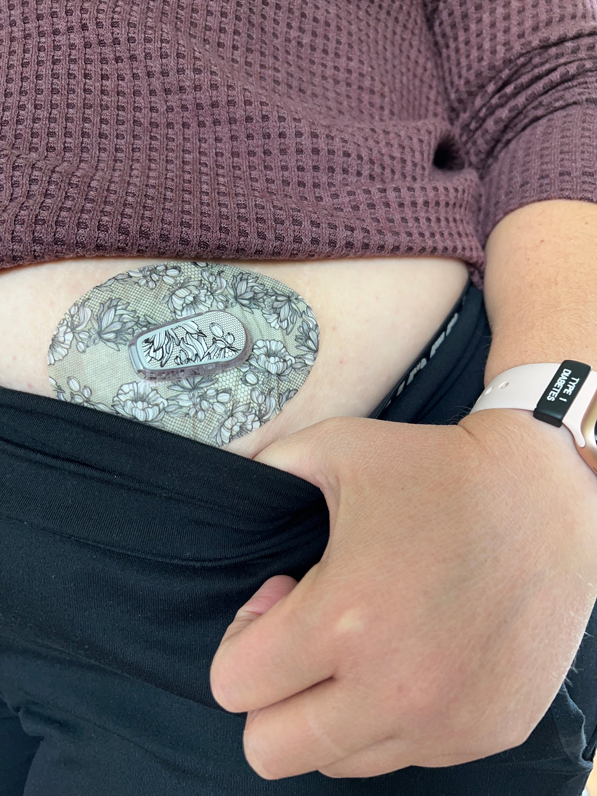 Person wearing Dexcom G6 CGM with Black Lace Dexcom G6 adhesive tape and matching vinyl center sticker  ExpressionMed
