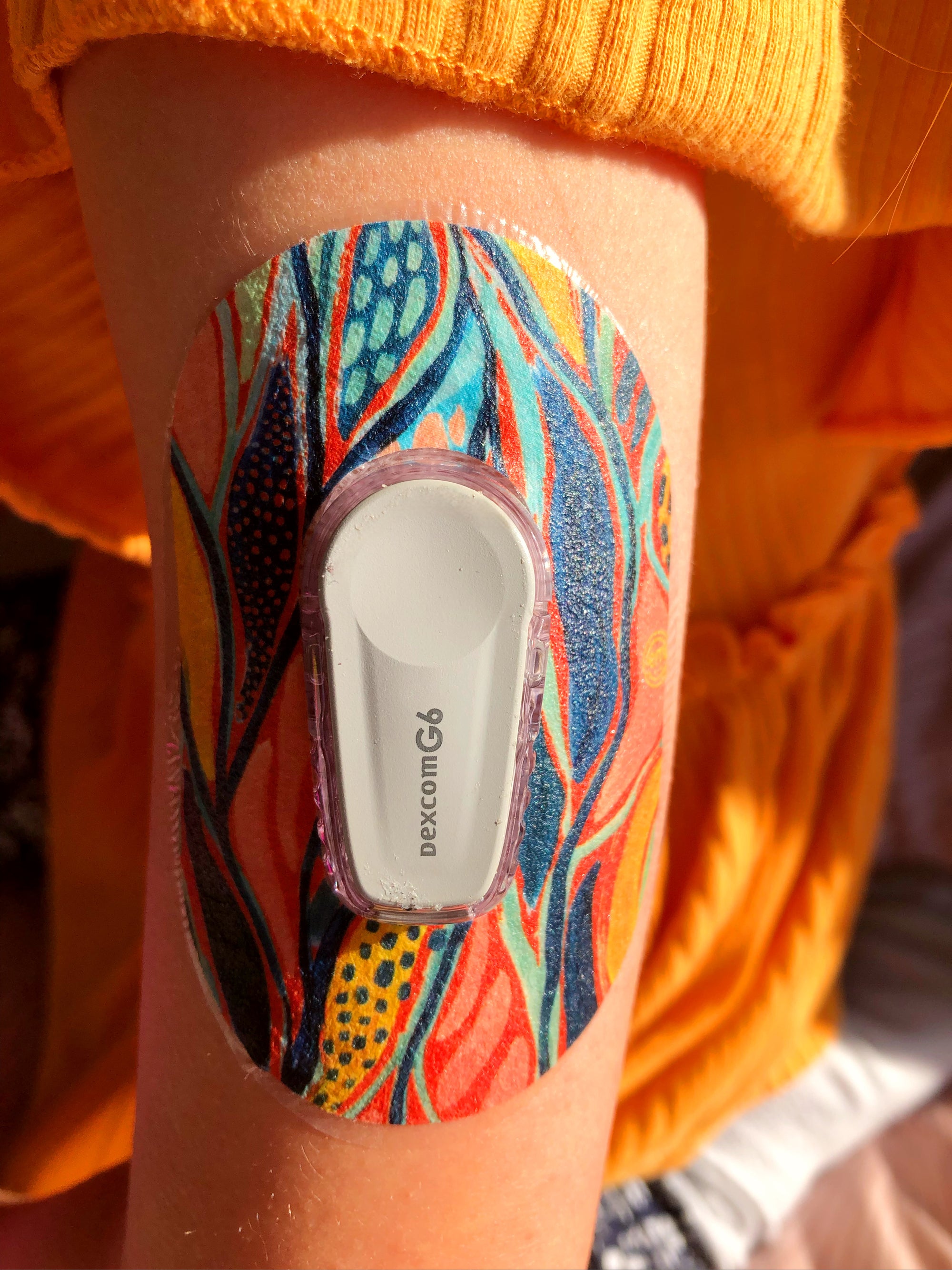 dexcom g6 transmitter with blue and orange seaweed design