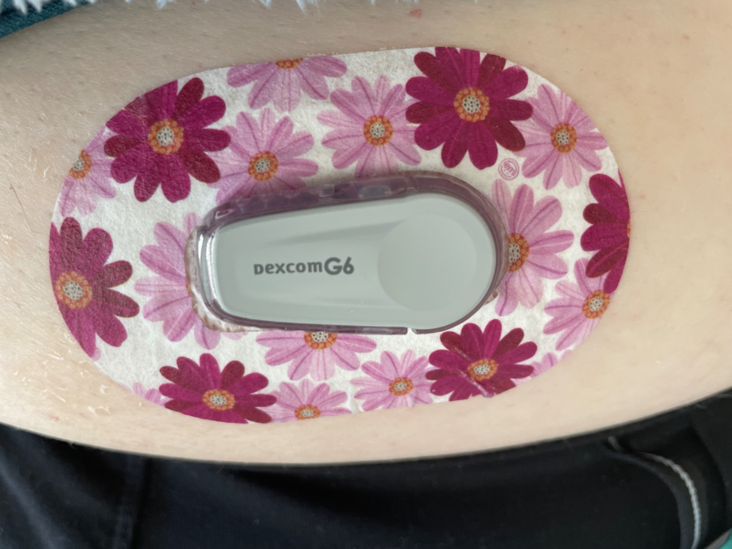 ExpressionMed Pink Craze Variety Pack Dexcom G6 Mini Tape