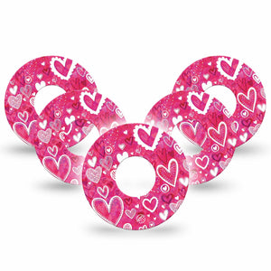 Whimsical Hearts Infusion Set Adhesive Tape, 5-Pack, Pink Heart design Valentine Themed CGM Adhesive patch