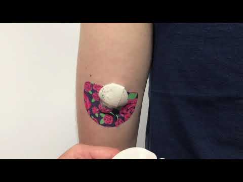 ExpressionMed 2-Piece Medtronic Tape Application Video, Medtronic Guardian Enlite, Man Applying Medtronic Tape