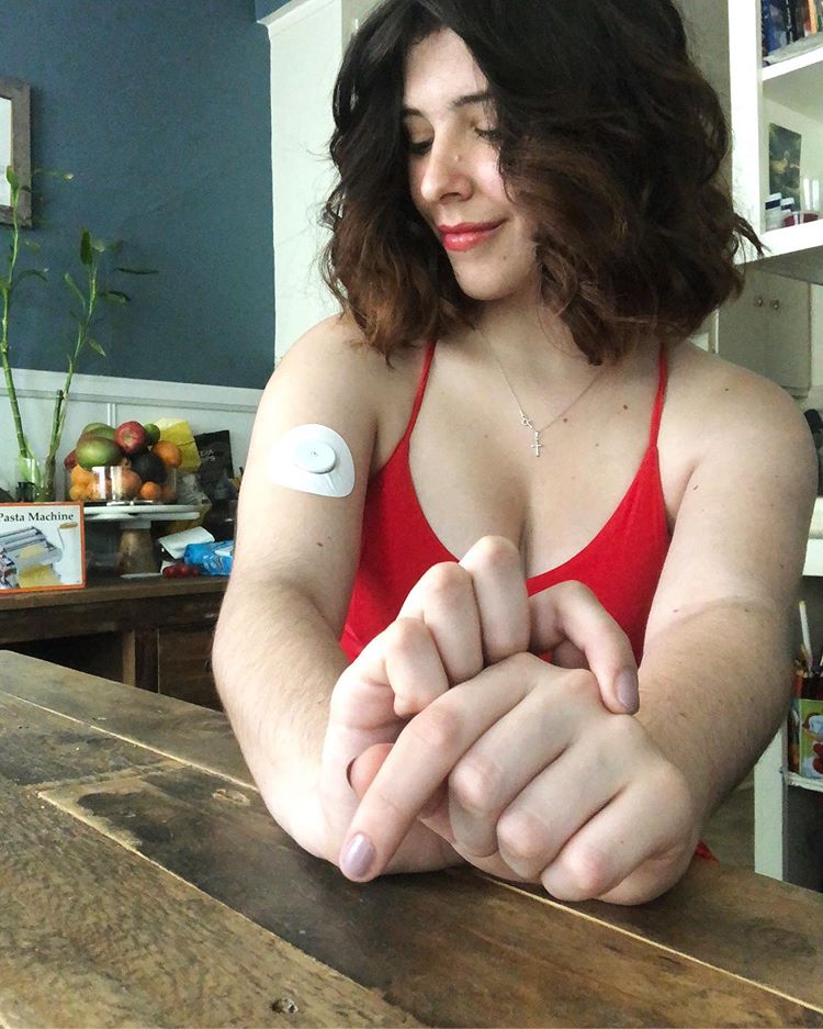 Woman with White Libre Tape on arm, Abbott Lingo