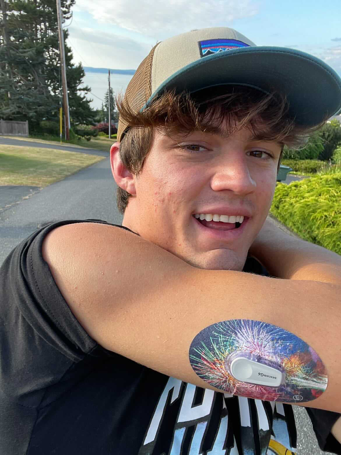ExpressionMed Teenage boy outside with Fireworks Dexcom G6 Tape on arm