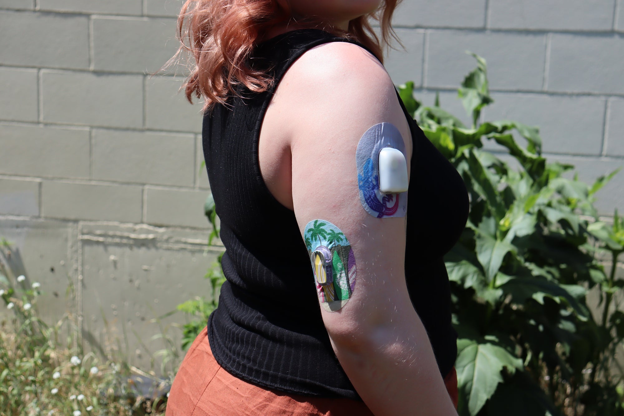 ExpressionMed Surfs Up Dexcom G6 Tape, Multiple Tapes, Woman Wearing Beach Themed CGM Adhesive Patch Design